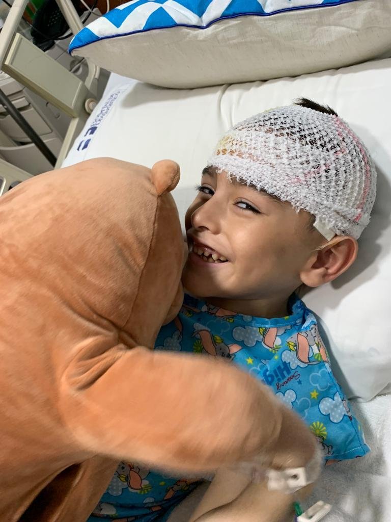 Operacion a paciente infantil con epilepsia refractaria 11