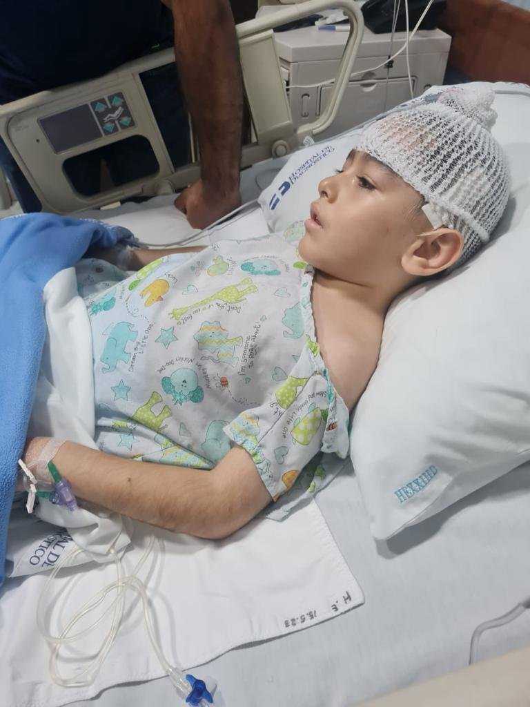 Operacion a paciente infantil con epilepsia refractaria 15